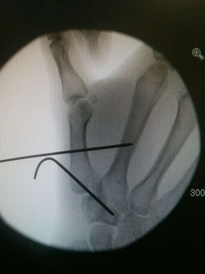 2014-09-14 Hand (1).jpeg