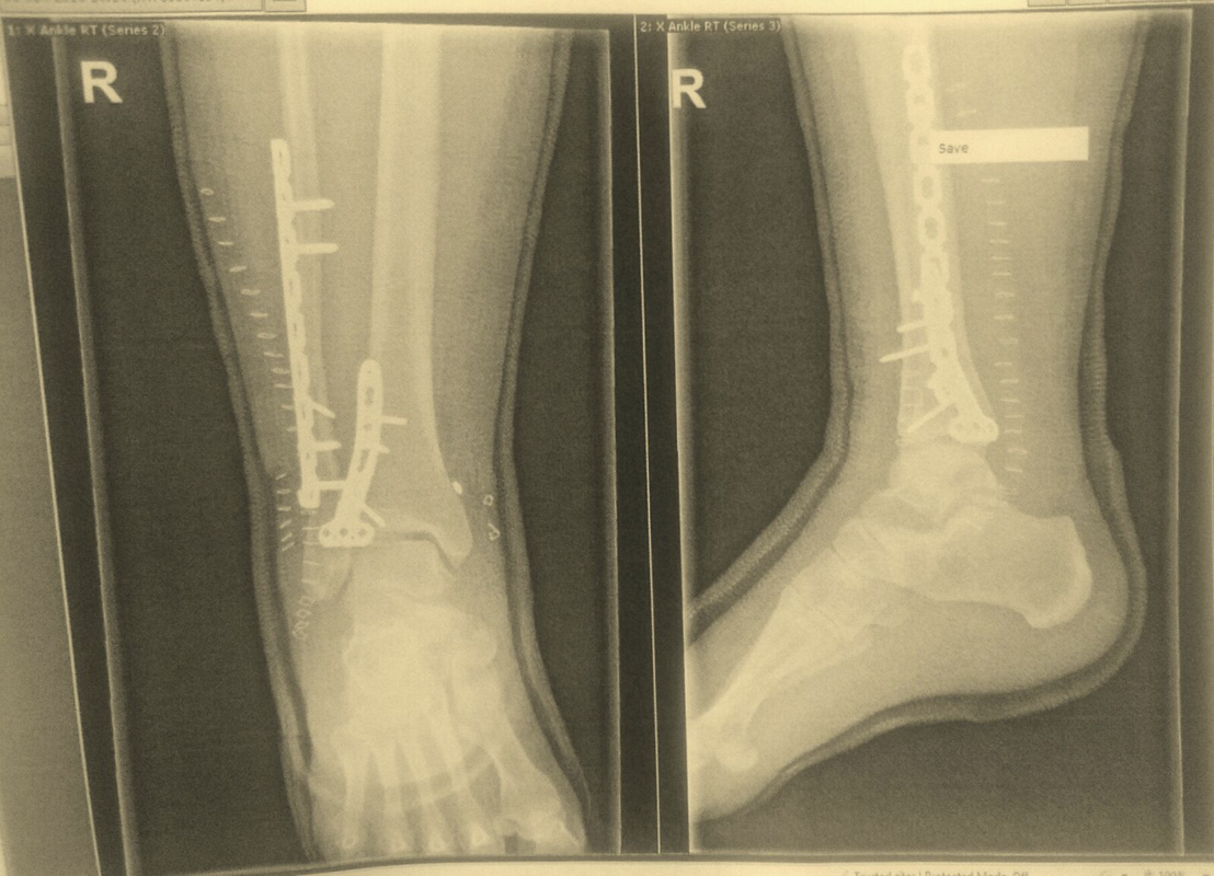 My Summer Was Over Before It Even Started