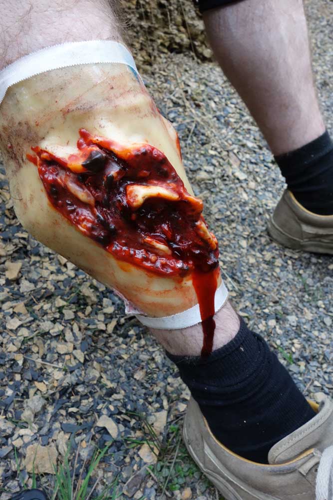 first aid education