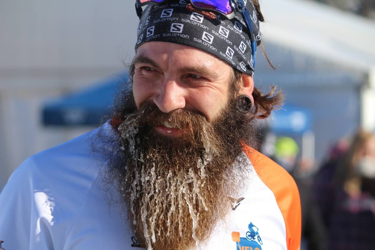 That's frost on his beard. No really. It's frost!