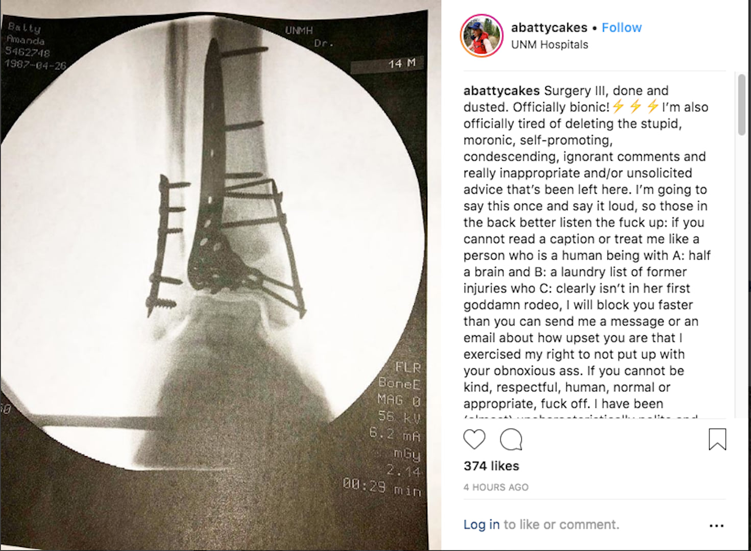 Downhill’s Most Outspoken Pro: Amanda Batty Announces Retirement