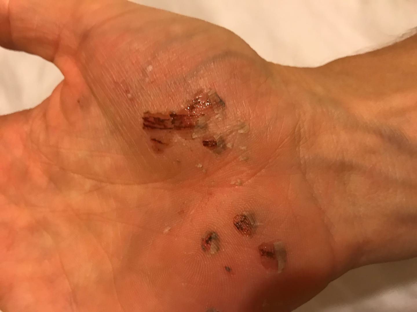 Gloves hangs crash ouch