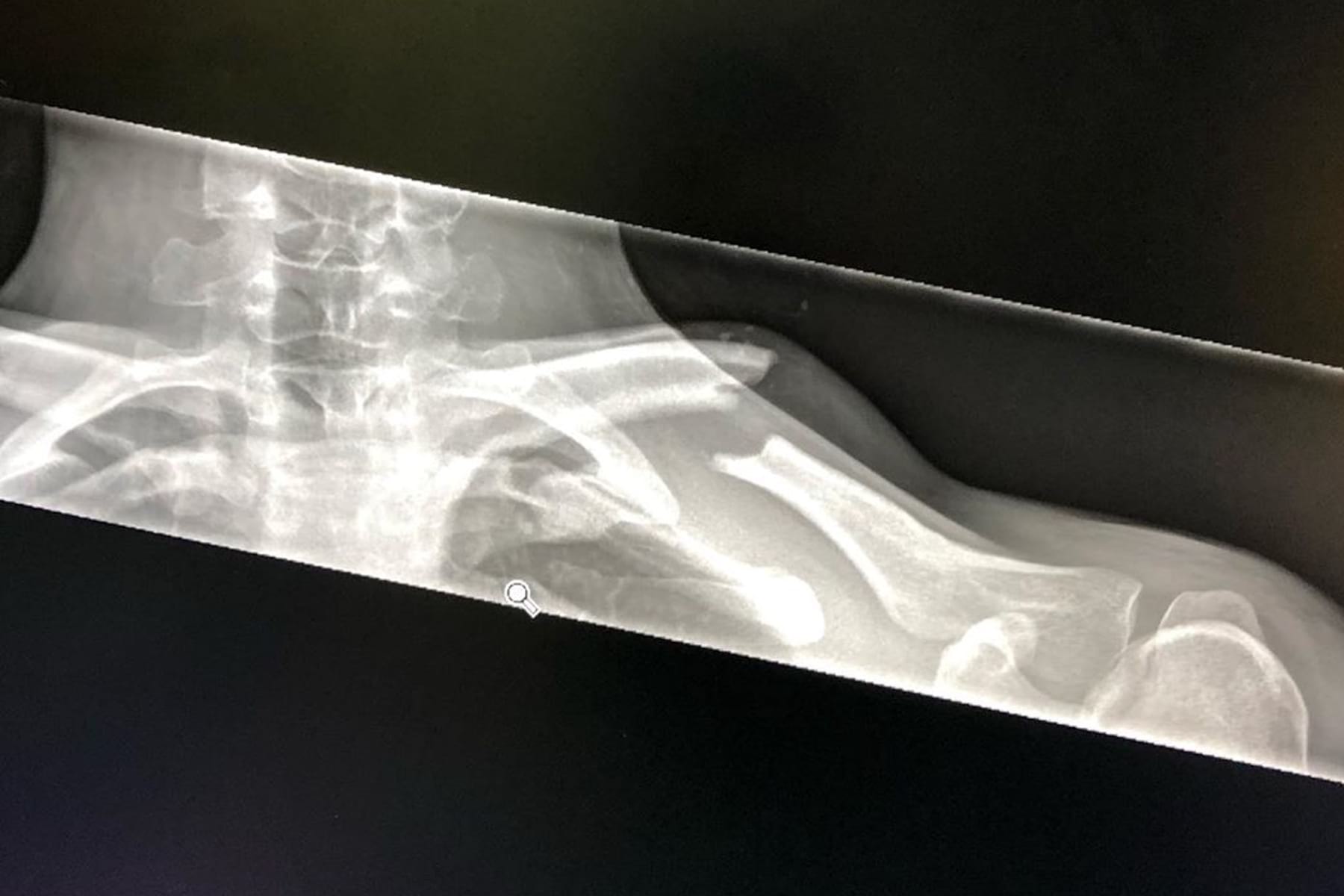 Crash Carnage at Fort William WC Downhill 2019