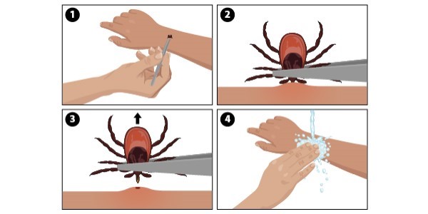 Ticks and Lyme Disease: Advice for Mountain Bikers